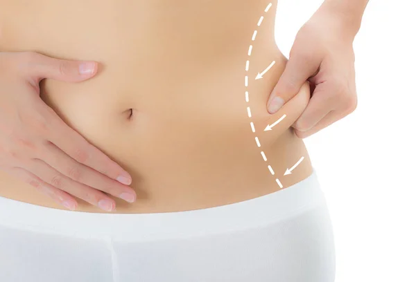 Cilt üzerinde çizim oklarla onu yanları kapma kadın kapatmak, kaybetmek ağırlık ve liposuction selülit Temizleme beyaz arka plan üzerinde izole kavramı,.