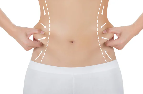 Onun yanları çizim oklar, kilo kaybetmek ve liposuction ile ciltte kapma kadın beyaz arka plan üzerinde izole selülit kaldırma kavramı,.