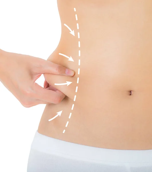 Onun yanları çizim oklar, kilo kaybetmek ve liposuction ile ciltte kapma kadın beyaz arka plan üzerinde izole selülit kaldırma kavramı,.