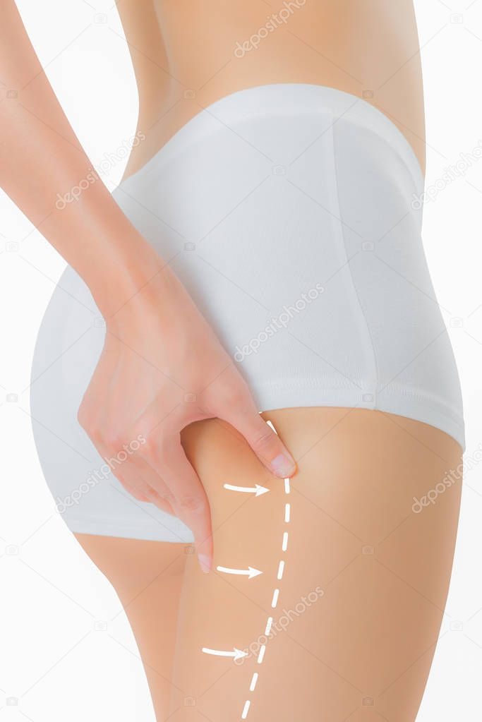 Woman grabbing skin on her buttock with the drawing arrows, Lose weight and liposuction cellulite removal concept, Isolated on white background.