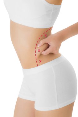 Kadın deri kırmızı renk ile onun kalça kapma işaretleme, kaybetmek ağırlık ve liposuction selülit kaldırma kavramı, göl kenarında beyaz arka plan üzerinde haçlar.