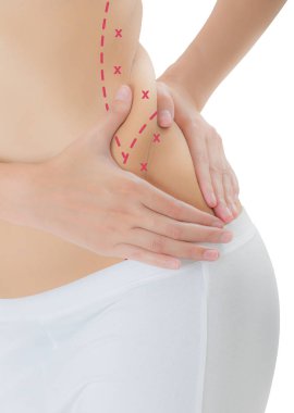 Kadın onun yanları kırmızı renk ile ciltte kapma yakından işaretleme, kaybetmek ağırlık ve liposuction selülit kaldırma kavramı, göl kenarında beyaz arka plan üzerinde haçlar.