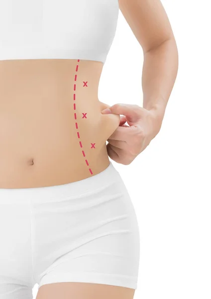 stock image Woman grabbing skin on her flanks with the red color crosses marking, Lose weight and liposuction cellulite removal concept, Isolated on white background.