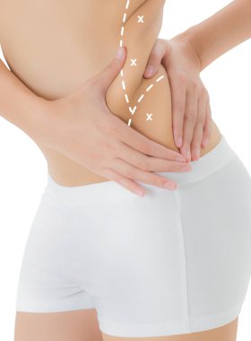 Woman grabbing skin on her flanks with the white color crosses marking, Lose weight and liposuction cellulite removal concept, Isolated on white background. clipart