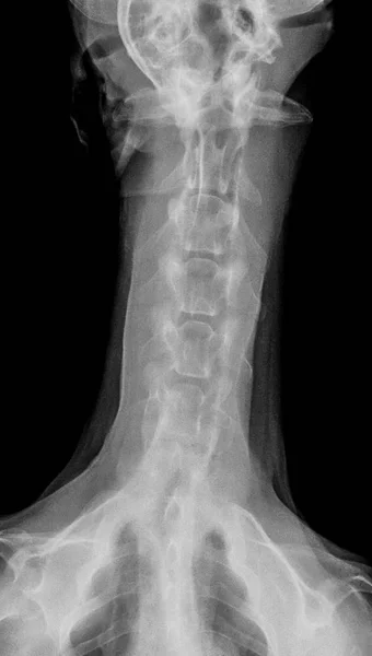 犬前观 线片在胸部标准和胸兽医医学及兽医解剖概念中的闭合 黑白颜色 — 图库照片