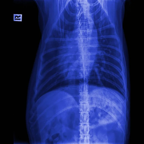 Рентген Переднего Вида Собаки Закрыт Грудной Клетке Стандартной Грудной Клетках — стоковое фото