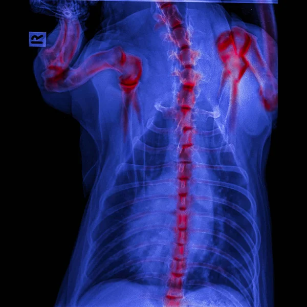 X-ray of dog posterior view closed up thorax and chest red highlight foreleg bone in shoulder joint and neck bone to back bone-degenerative joint disease in dog- Veterinary medicine-Veterinary anatomy