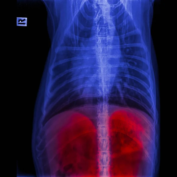 Рентген Собаки Передній Вид Закритий Стандарті Грудей Грудей Червоним Підсвічуванням Стокове Фото