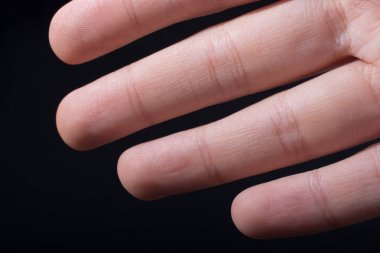 Bir çocuğun dört parmağı kısmen siyah arkaplanda görülüyor