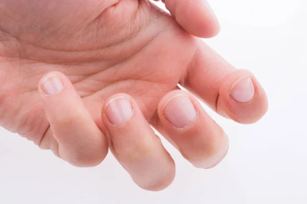 Hand Met Haar Vingers Nagels Een Witte Achtergrond — Stockfoto