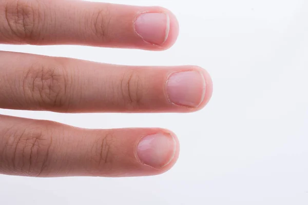 Χέρι Δείχνοντας Δάχτυλα Και Νύχια Λευκό Φόντο — Φωτογραφία Αρχείου