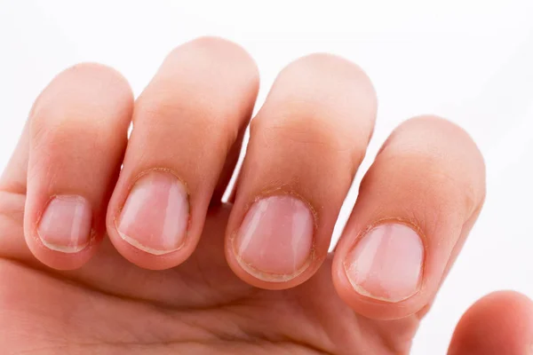 Hand Met Haar Vingers Nagels Een Witte Achtergrond — Stockfoto