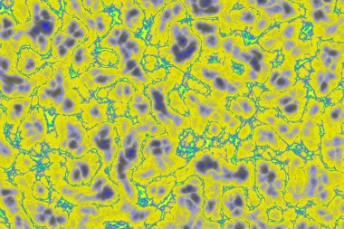 Radiatingas bir arka plan yıldırım cıvata 