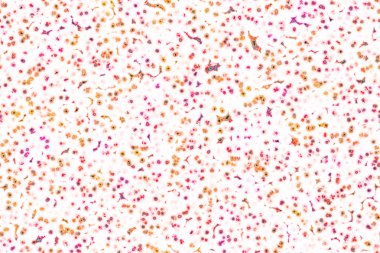 Bakteri hücre şekli: cocci, basiller, spirillum bakteri 