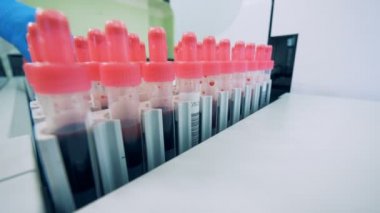 Bir test makinesi modern bir laboratuarda çalışırken kan örnekleri bir otomatik olarak, gidin.