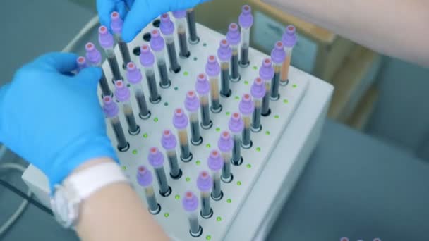 Clinic worker takes samples from a rack at a modern clinic. — Stock Video