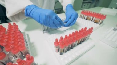 Laboratuvar işçi tüpler, durumlarını bir hastanede kontrol görünüyor. 4k.