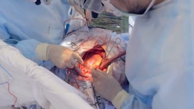 Gerçek kalp açık göğsünden ameliyat sırasında yener..