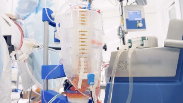Medizinische Maschinen, medizinische Geräte arbeiten im Krankenhaus. — Stockvideo