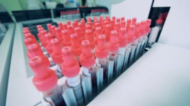 Test tüpleri nakli kanla dolu