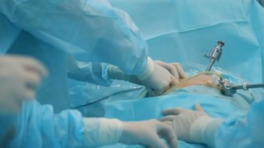 Laparoskopik cerrahi cerrahlar bir ekip tarafından gerçekleştirilen