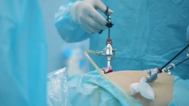 Läkare utför en endoskopisk operation — Stockvideo