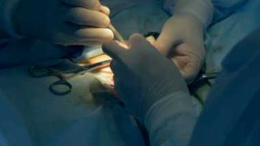 İnsan bir iç organ parçası yakın bir yukarı işletilmektedir