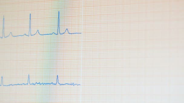 ECG moniteur montre un rythme cardiaque sain . — Video