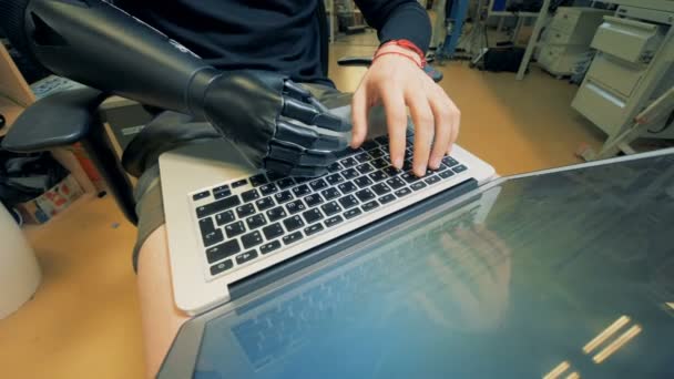 Disabled person works with a laptop, close up. — Stock Video