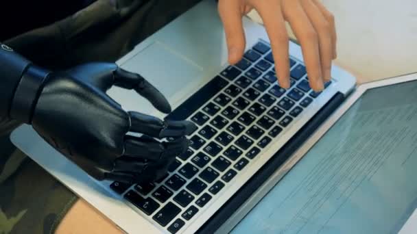 Ein Mann tippt mit seiner prothetischen Hand auf seinem Laptop. 4k. — Stockvideo