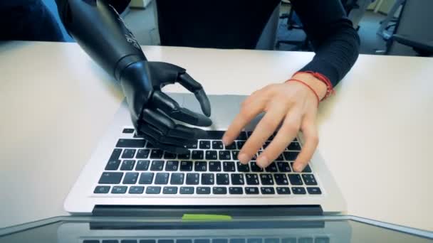 Working person with one artificial arm, top view. — Stock Video