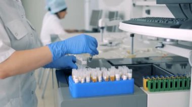 Kadın el probları madde ile yerinden yakın çekim