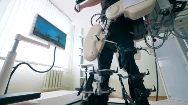 Equipamento protético com um paciente em um hospital, de perto . — Vídeo de Stock