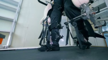 Özel bir protez hastalarında bacaklarda yakın çekim.