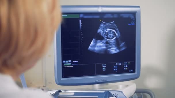 Monitor de ultrassonografia com imagem de feto. Ultra-sonografia médica . — Vídeo de Stock