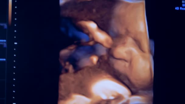 Close up van een echografie beeld van een baby. Echte foto van een ongeboren in de baarmoeder. — Stockvideo