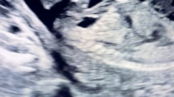 Baby in moederschoot is bewegen tijdens echografie — Stockvideo