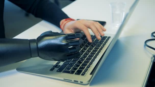 Man prosthetic and normal hands are typing on the keyboard. — Stock Video