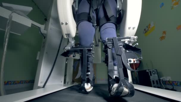 Máquina protésica en el trabajo en un hospital, de cerca . — Vídeo de stock