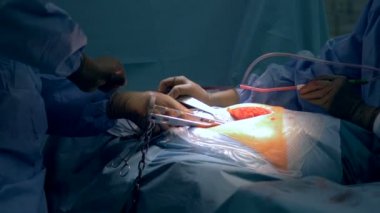 Bir cerrah çalışmalarını görüntülemek için yakın çekim.