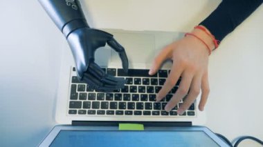 Biyonik protez bilgisayarda çalışarak yapay robot el ile erkek cyborg.