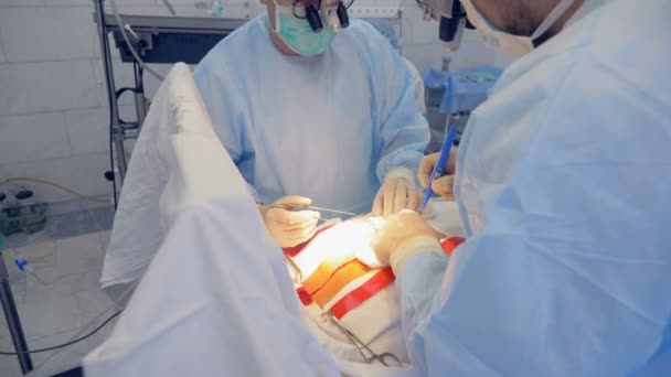 Cirujanos haciendo una incisión en un corazón, de cerca . — Vídeos de Stock