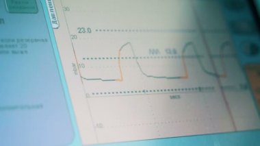 İş yerinde cardiographic İzleyicisi'nin yakın çekim
