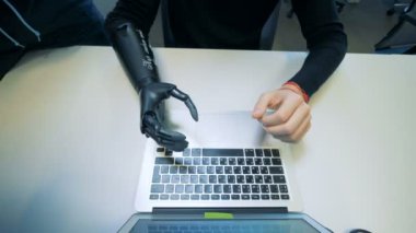 Yapay el türleri bir dizüstü bilgisayarda olan adam. Cyborg kavramı.