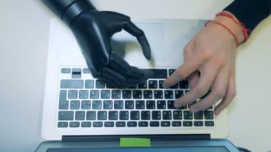 Prostetik ve klavyede yazarak sağlıklı bir el. Fütüristik insan cyborg kavramı.