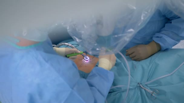 Врачи используют современное медицинское оборудование в операционном зале . — стоковое видео