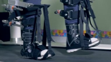 Ortopedik parça yürüyüş çocuk bacakları yan görünüm