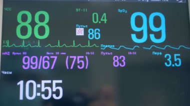 Çeşitli rakamlar ve tıbbi bir ekran dizinlerde kapatın. EKG monitör.