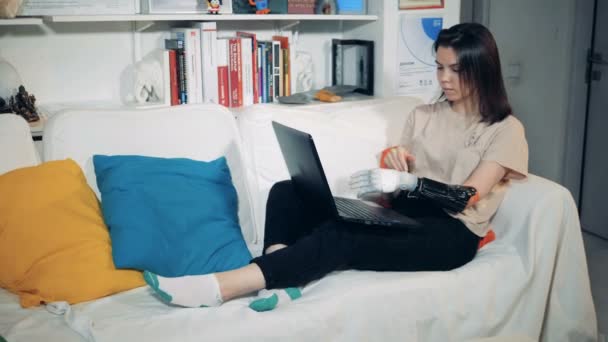 Dívka s funguje bionická protéza s přenosným počítačem, zblízka. — Stock video