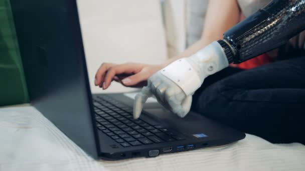 Um saudável e um biônico mãos femininas estão digitando em um laptop — Vídeo de Stock